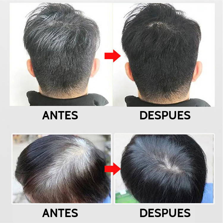 Dexe™ Shampoo Cubre Canas